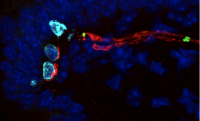 Merkel cells (blue) in skin detect light touch. Image: Ellen Lumpkin / Columbia University Irving Medical Center
